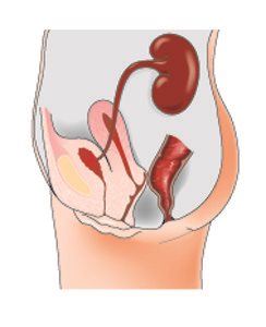 Peritoneal Mesothelioma